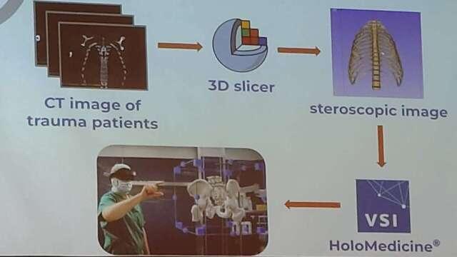 從1周變半小時！台灣獨研AI 3D重構技術 醫療「元宇宙」助攻精準手術