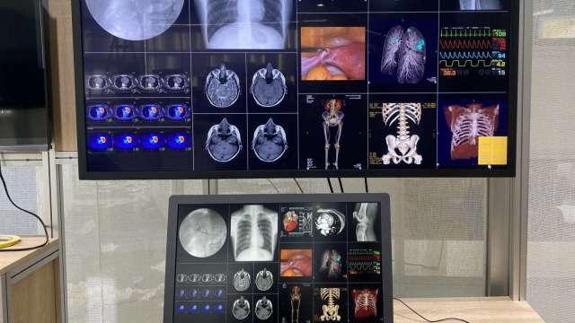 鈺緯科技參與醫療科技展 首度亮相Mini LED醫療顯示器